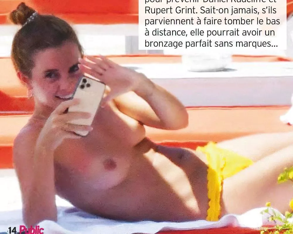 Emma Watson sunbathing naked. Published by the French magazine “Public”