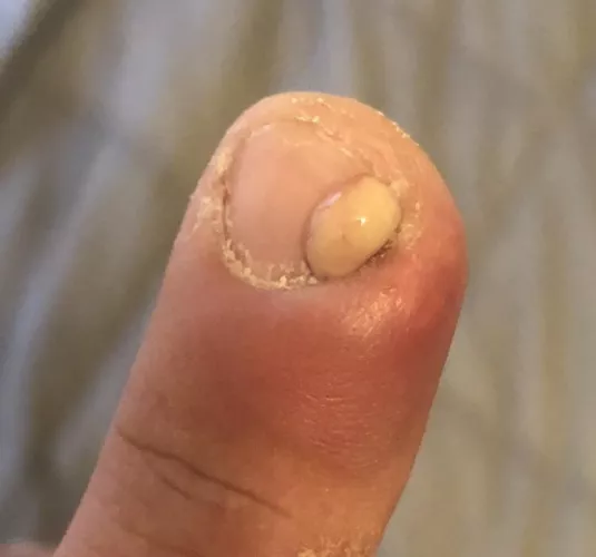 I really need to stop picking my nails. This hurt, sorry I couldn’t get video.