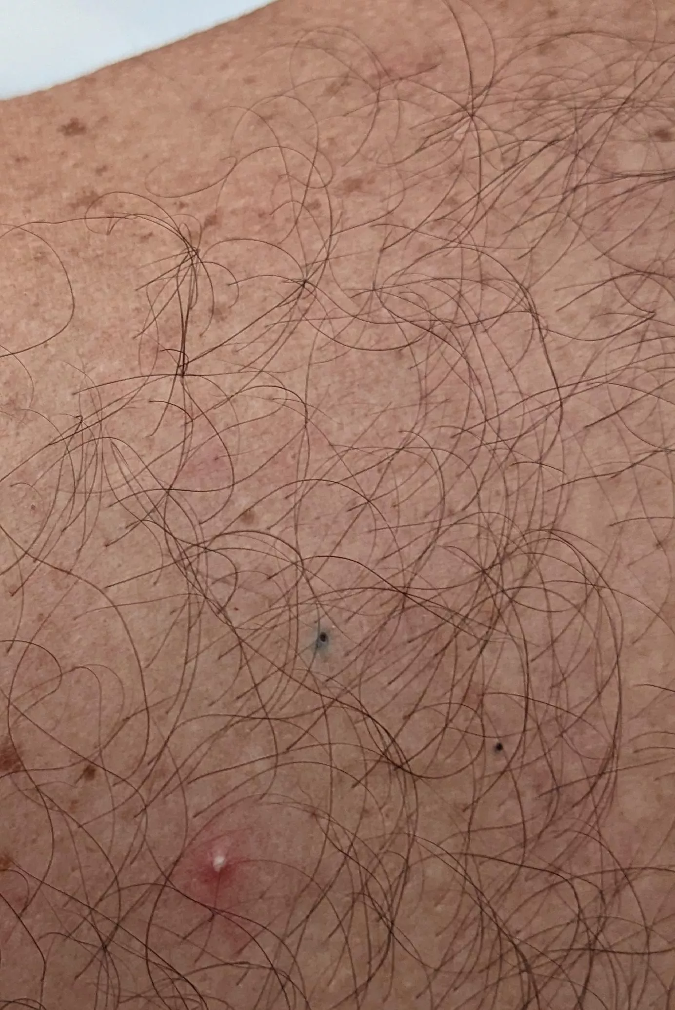 Out on the boat with my parents and husband... my dad's back is covered in stuff like this and he refuses to let anybody touch it 🙃😒