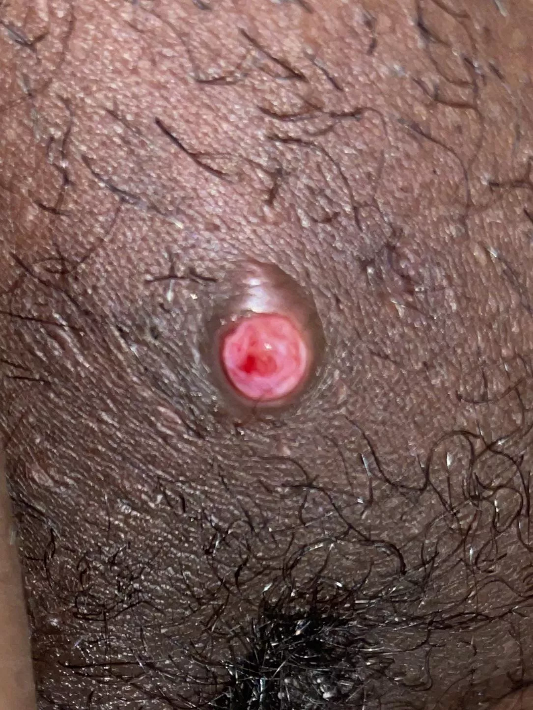 What is this? It’s super painful.
