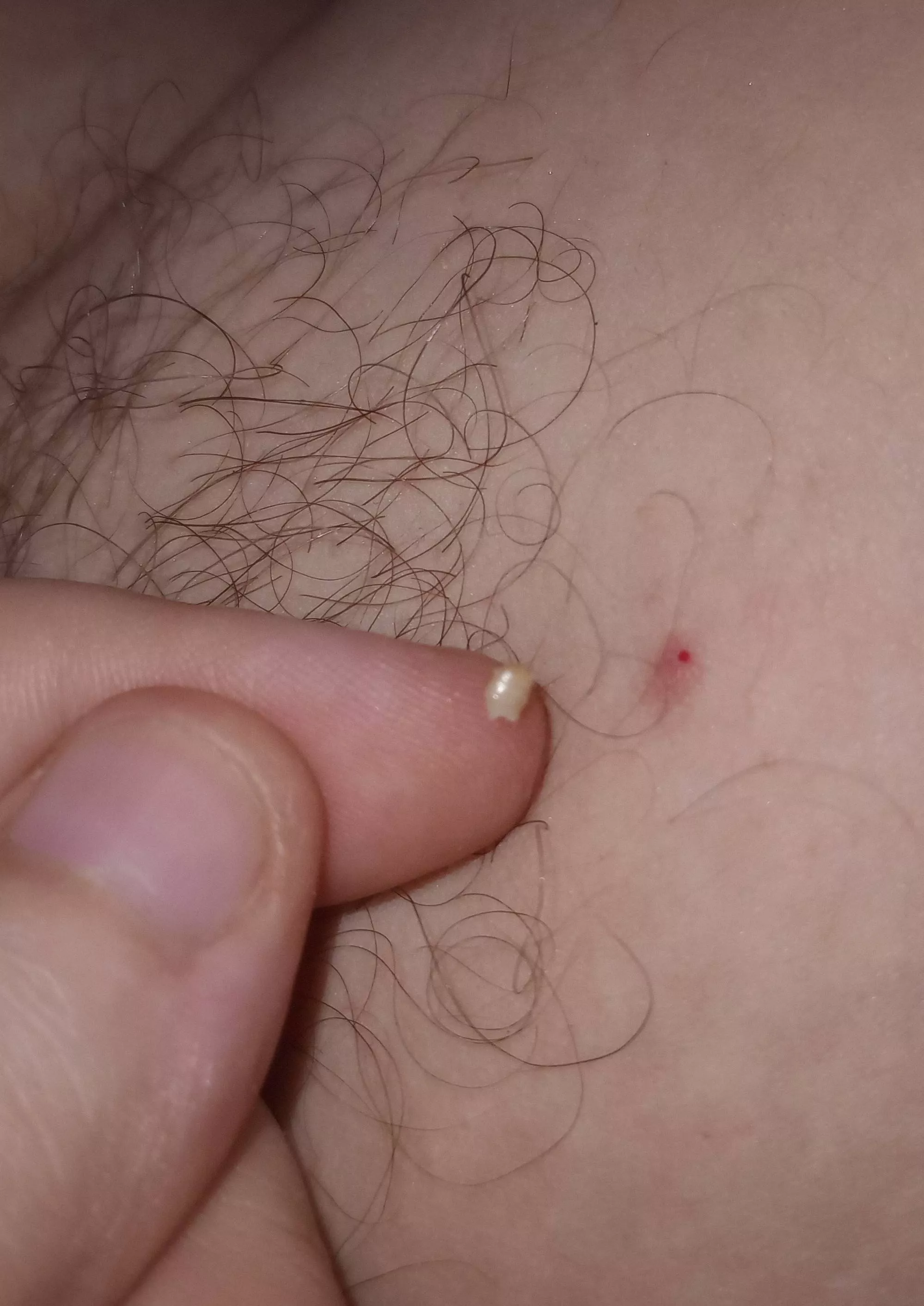 I popped this out of my girlfriend's armpit and I think I came