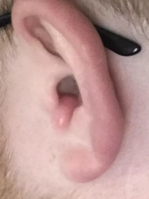 Any idea what this is in my ear and how to deal with it?