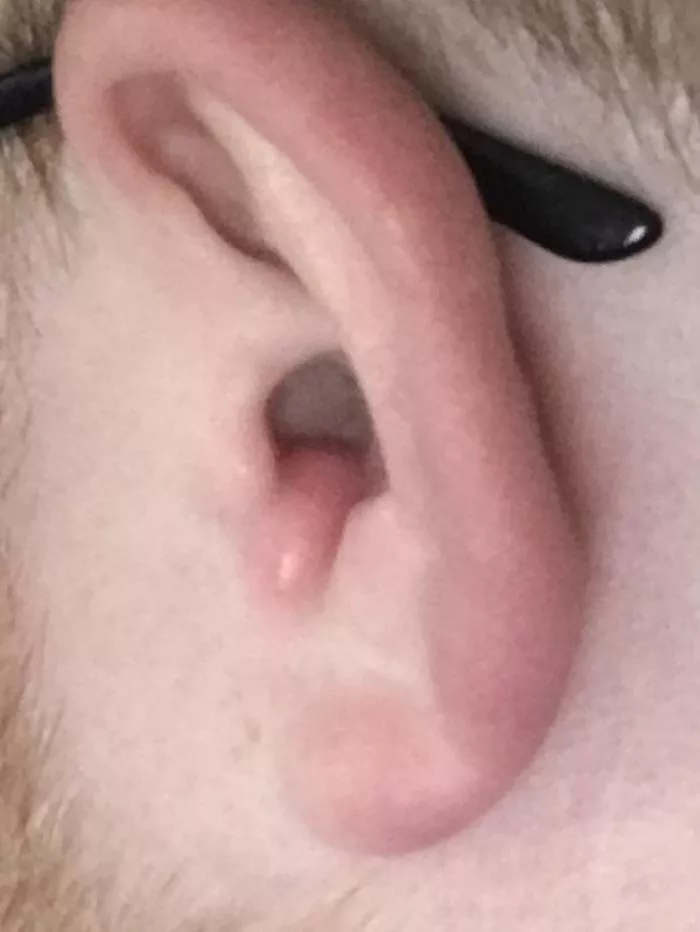 Any idea what this is in my ear and how to deal with it?