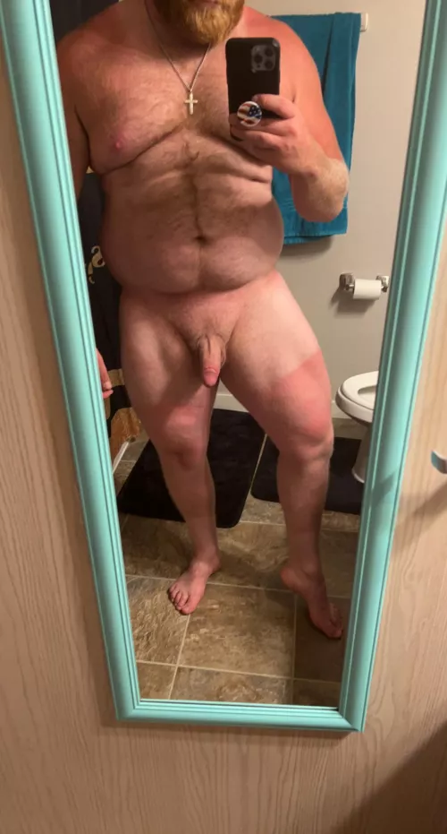 I think I burnt my legs at work today😅