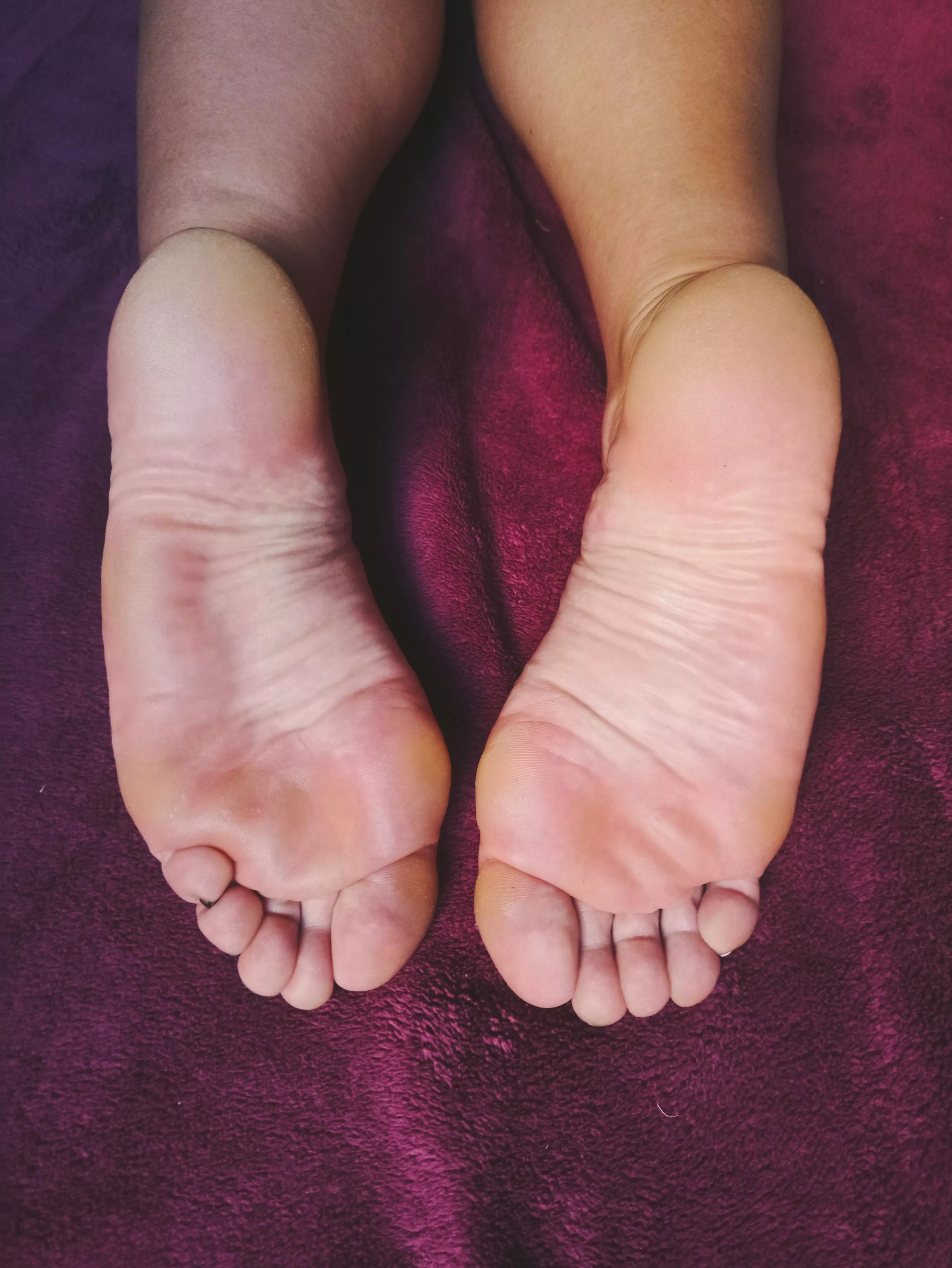What would you do with these soles, if you can do anything?