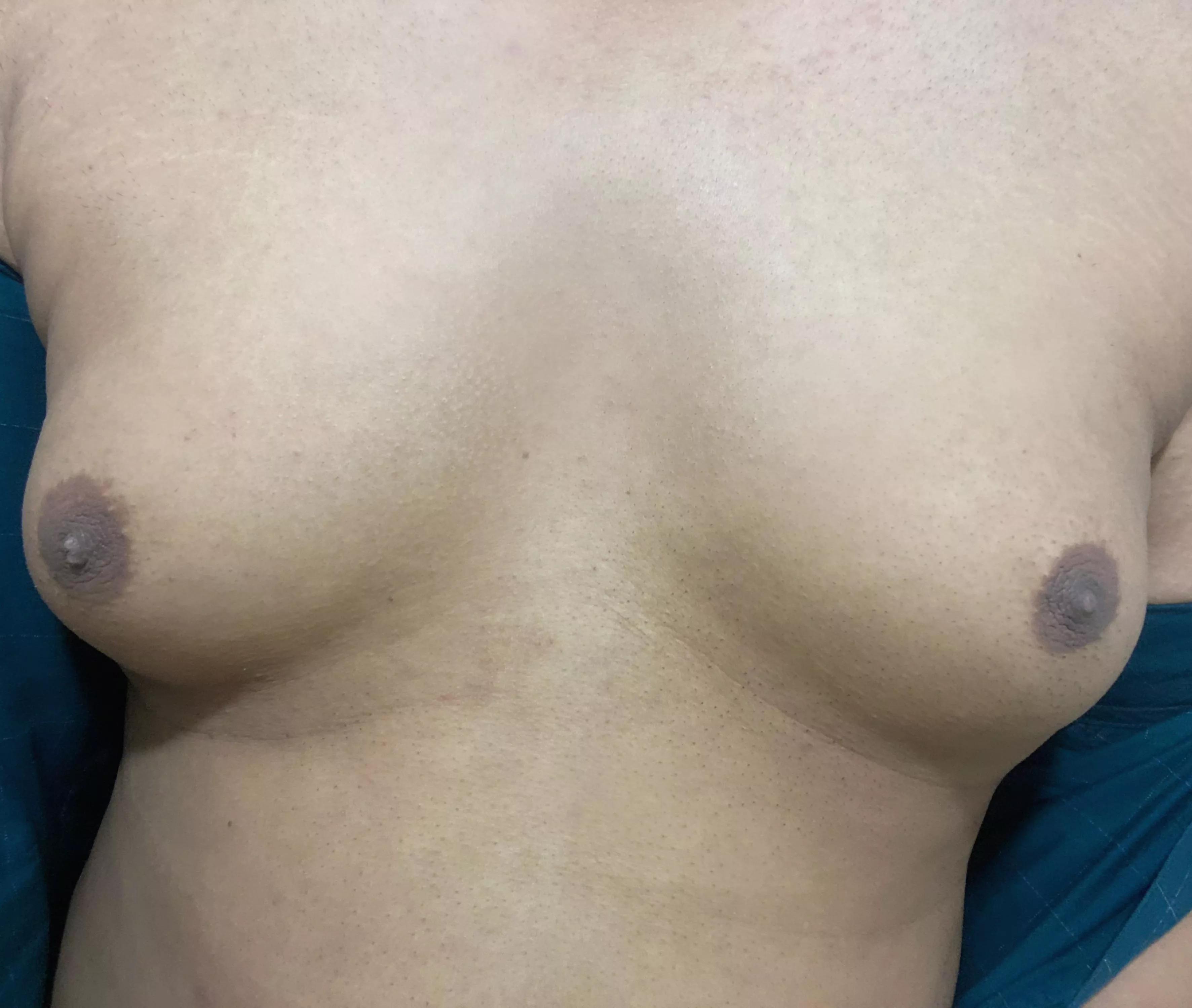 Does it look feminine enough? No hormones all natural. Any idea on how can I make it bigger?