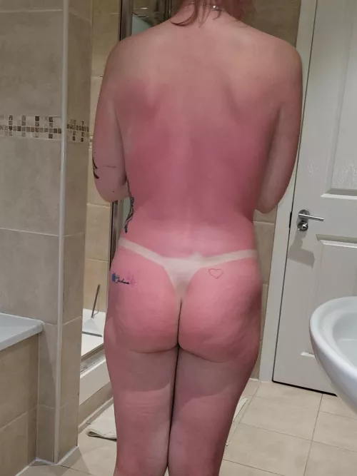 i think i maybe burn at least i got a tanlines any volunteers to cream me up (NSFW)