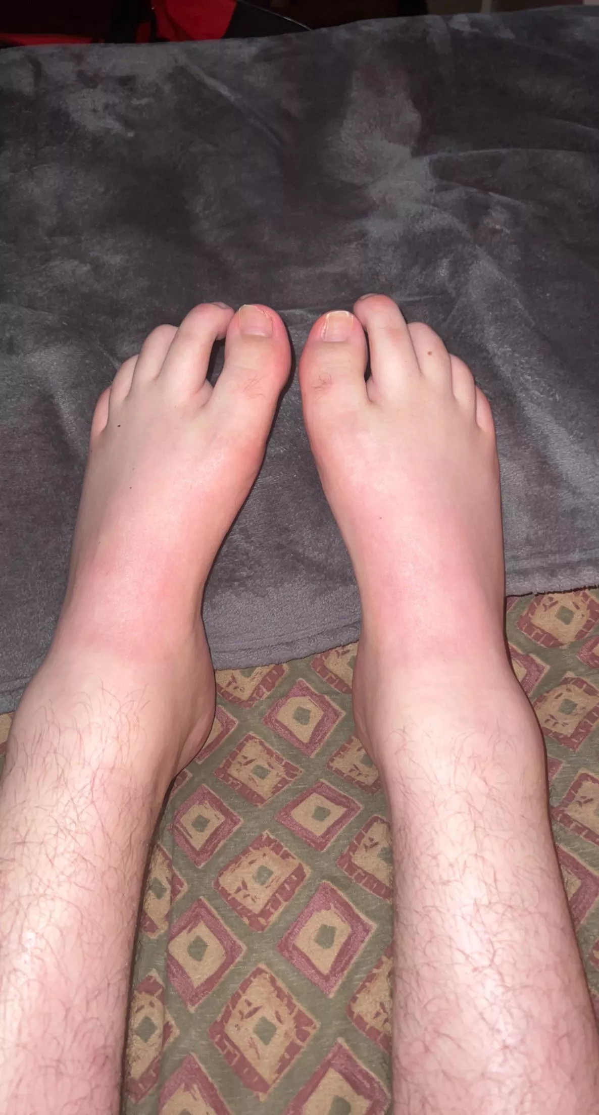 Come worshipp these beautiful unique feet boys ;)
