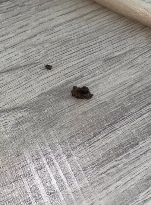 i pulled this chunk of earwax out of my ear today