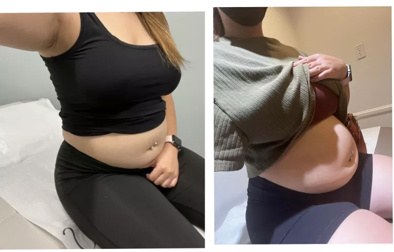 Another year, another doctor’s visit. My doctor thought I was preggers 😫😫😫