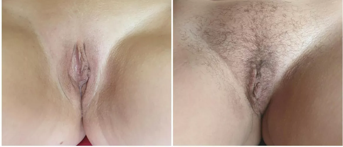 my 40 year old pussy, before and after.