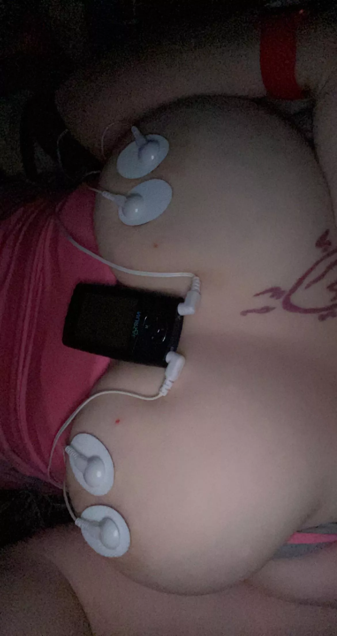 Tens Unit for lactation