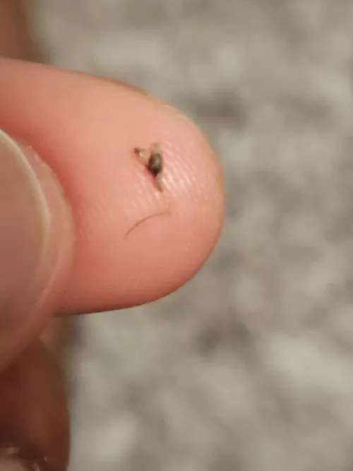 Felt a bump at the edge of my hairline for a month. Finally decided to squeeze it and this bad boy came out