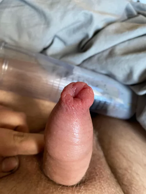 Is it normal for it to swell up like this after pump just curious