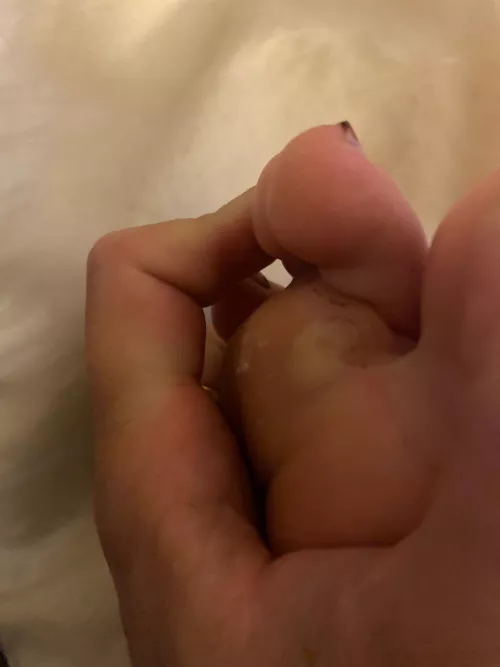 To pop or not to pop? 12 days walking 8 miles, today off, 9 more.