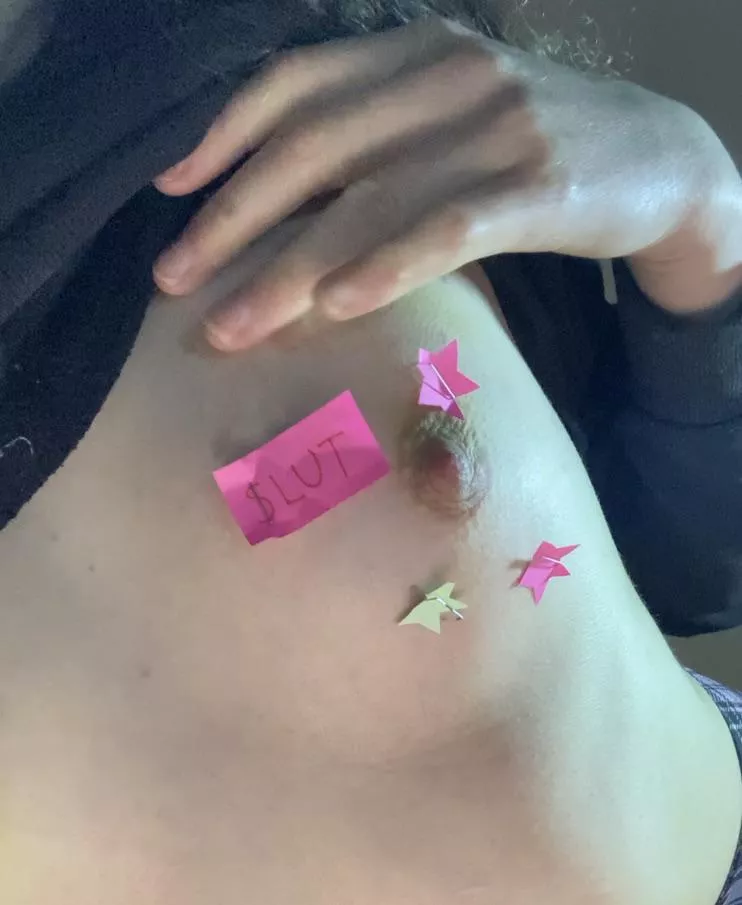[F] Stapled 🥺