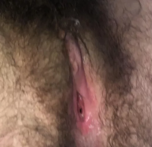 My open hole