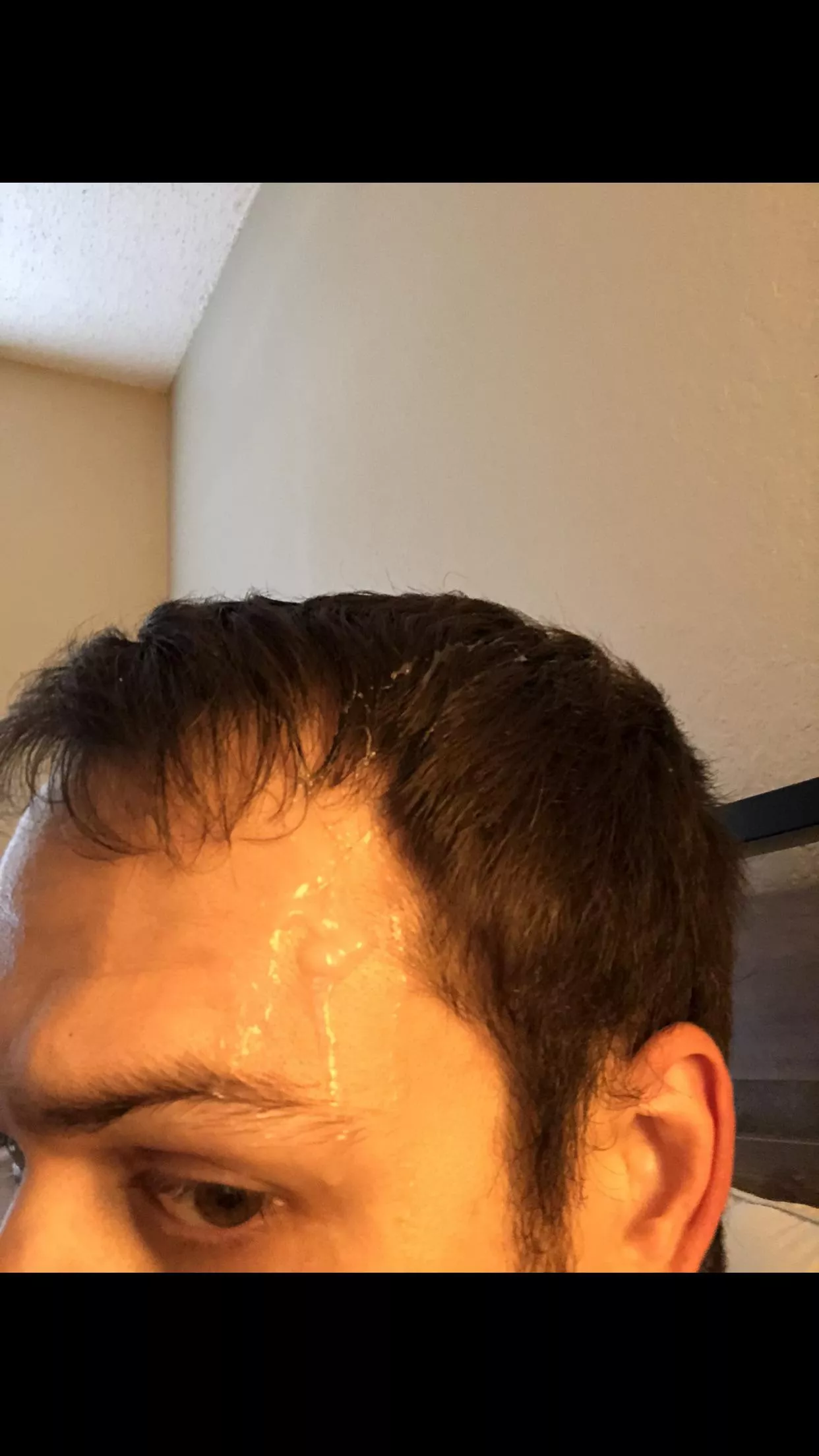 Overshot my tissue 2/2