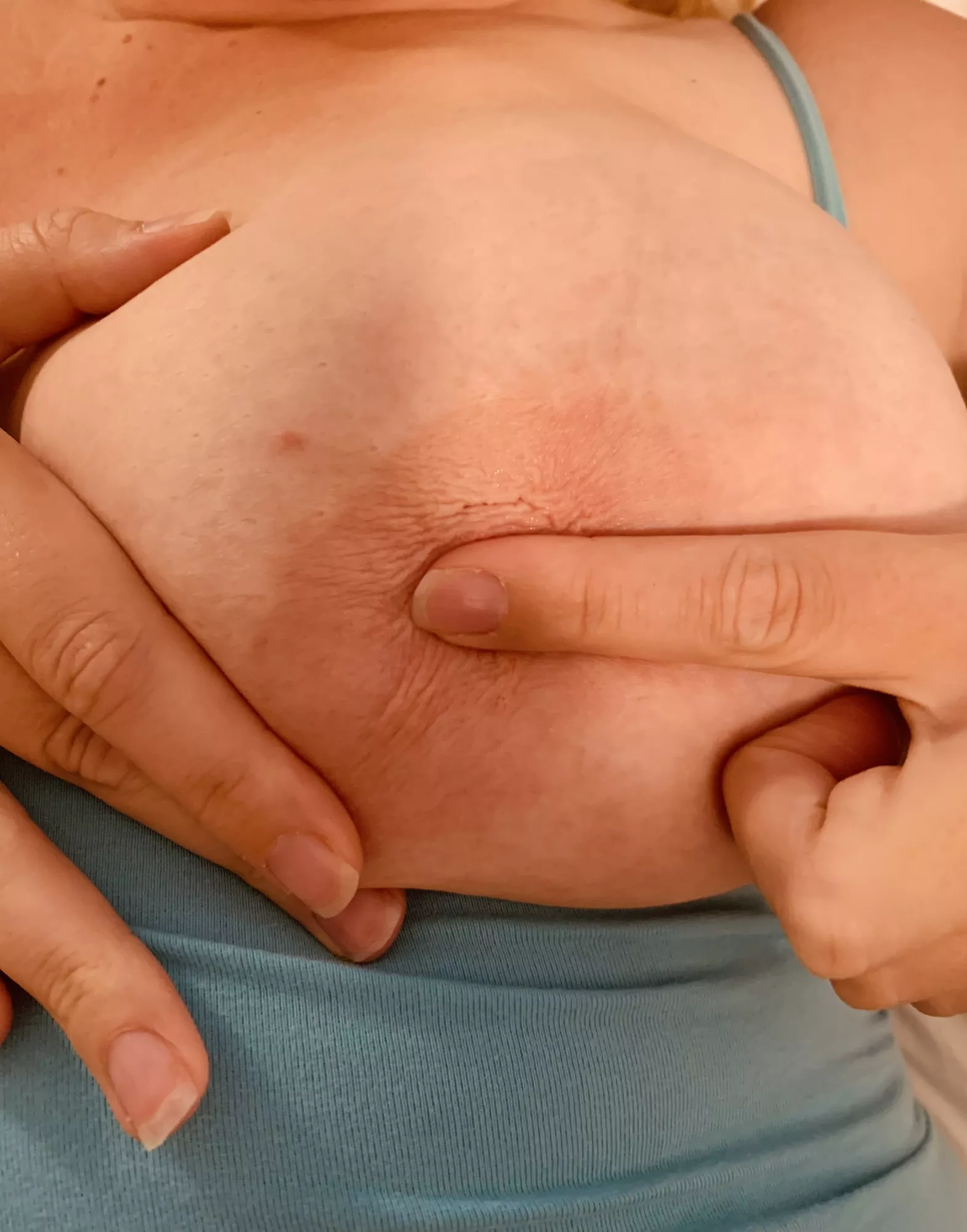 Can you see the bite marks?