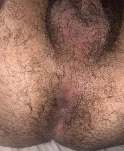 I always feel the need to clarify that I have a birthmark by my butthole lol