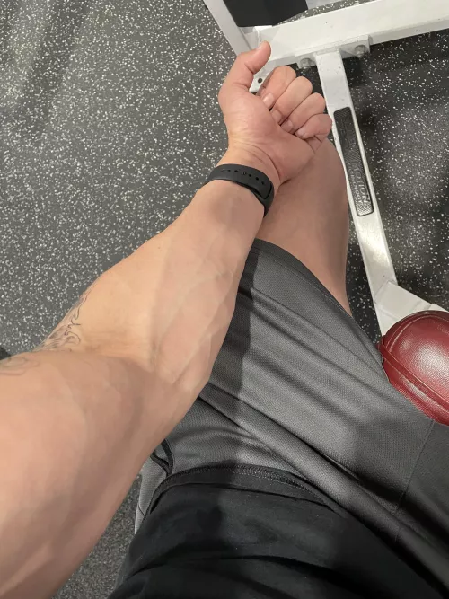 The nurse never has issues finding a vein