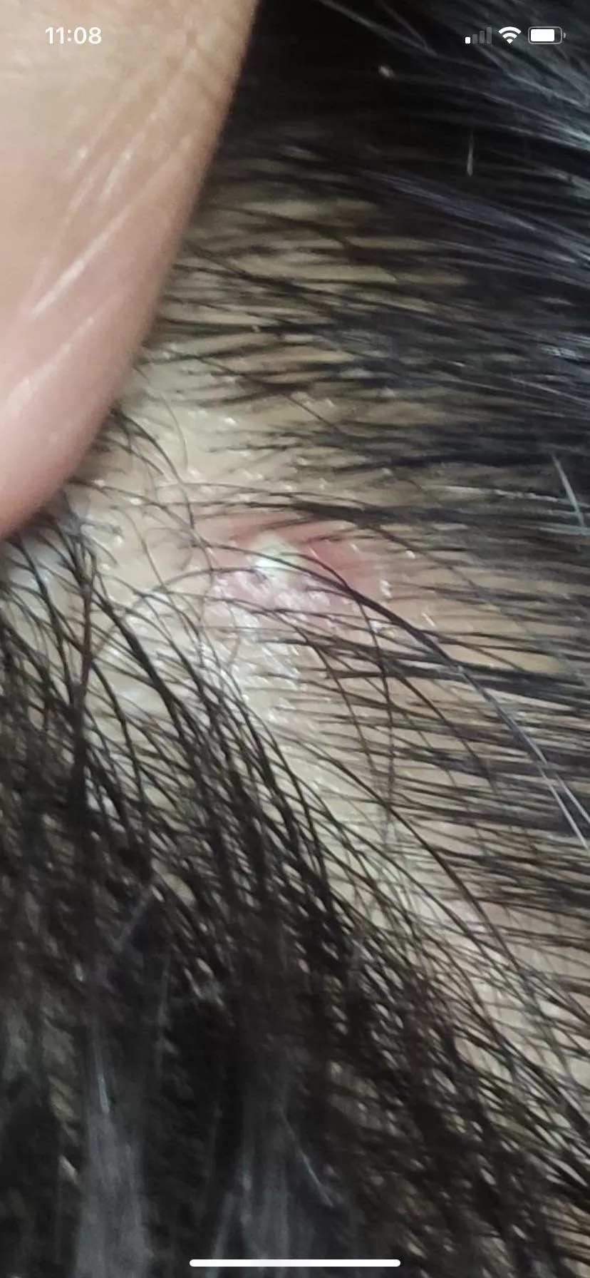 Found this pic on another subreddit, dear god I would pay money to pluck that hair and watch the goop come out …