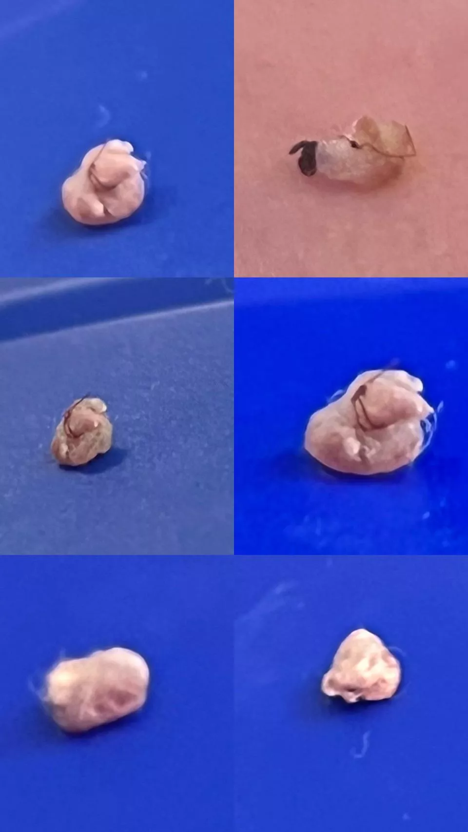 It came from withChin…it percysts….