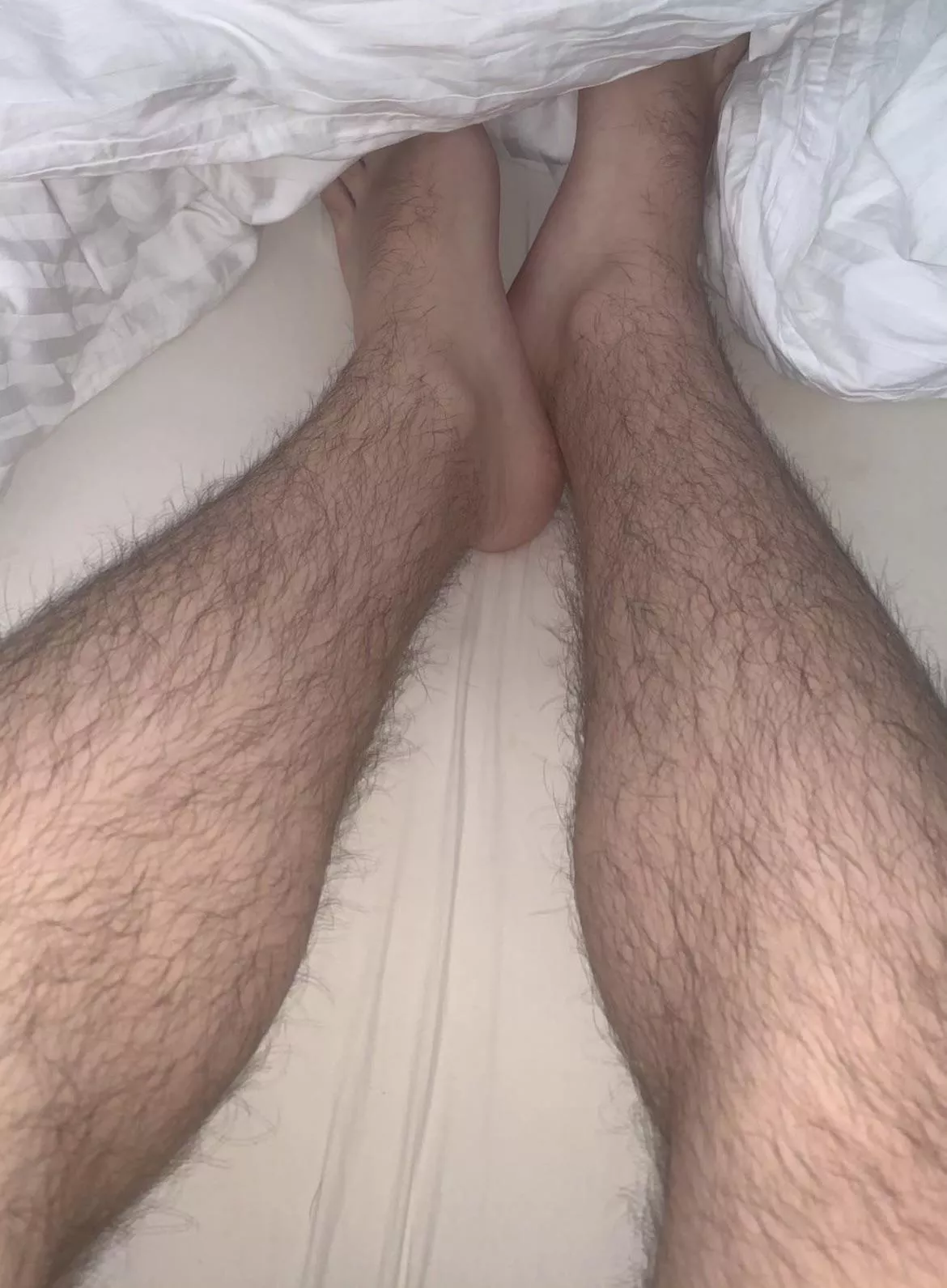 My leg hair continues to the top of my feet… (19)