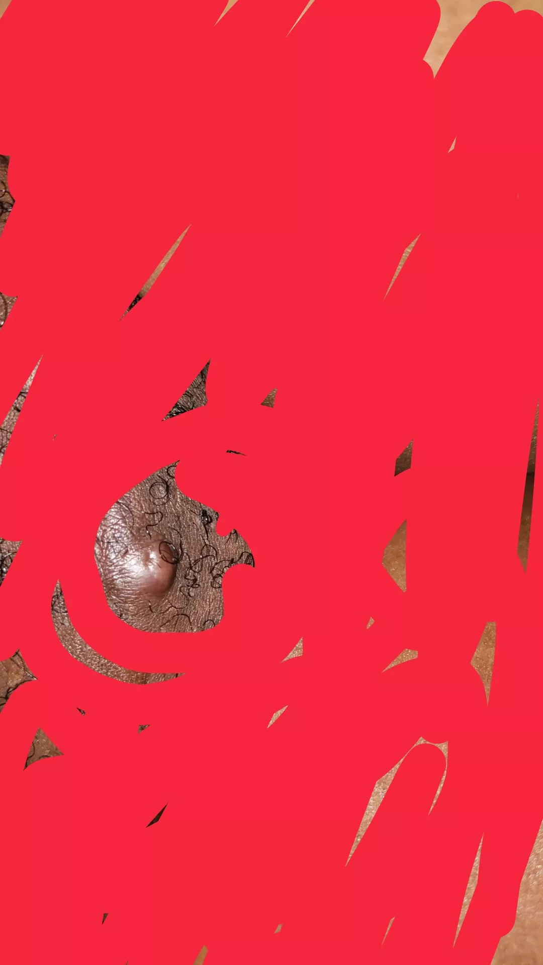 pimple on my pubic mound. ready to pop but is it ready?