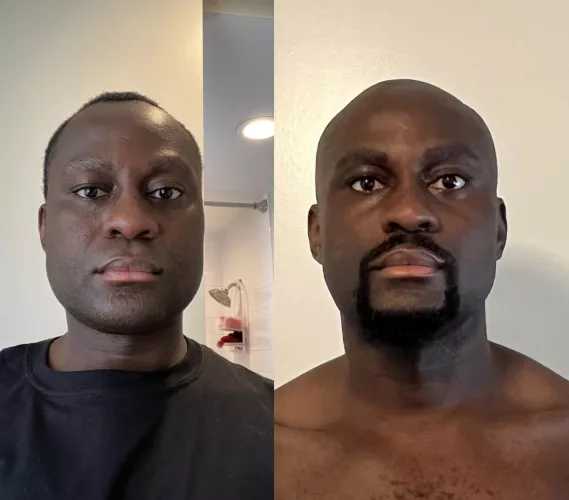 Bi 33 yr old math teacher here - Decided to shave my head bald after months of being insecure about my receding hairline. New school year = New Look = New Confidence