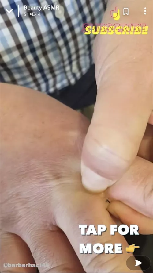 Found this weird vid on snap. He squeezes what seems like hairs or metal shavings out from between us fingers. Wtf is this?
