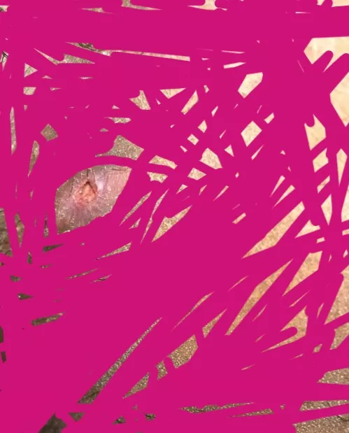 What is happening?? boil popped on its own and it went down and then a red bump popped up on the healed scar and then this happened? this was also on my inner thigh near private area where it rubbed constantly against my skin. I'm going to get me an app