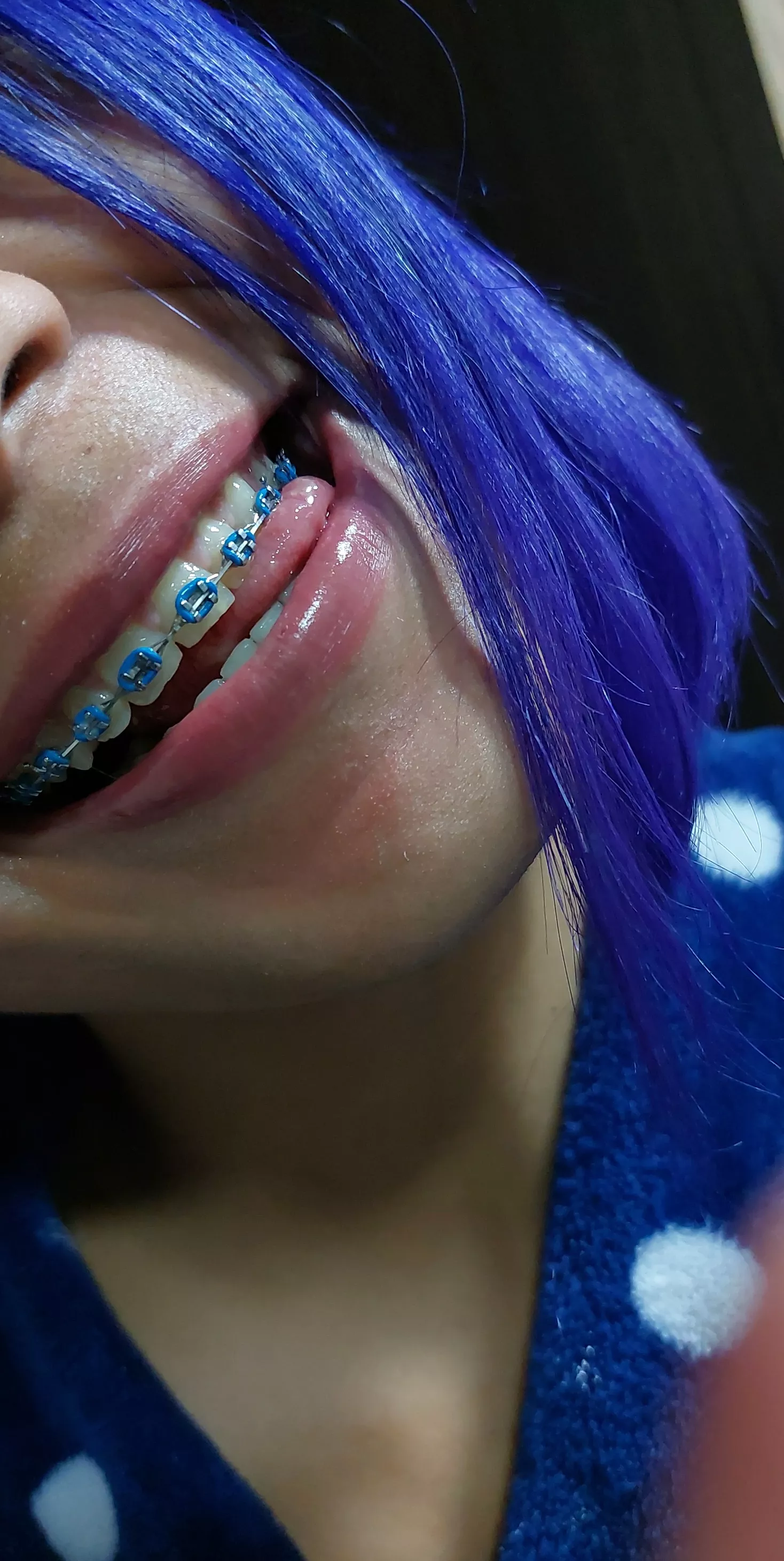 the blue of my braces combines with the white of your milk..😉