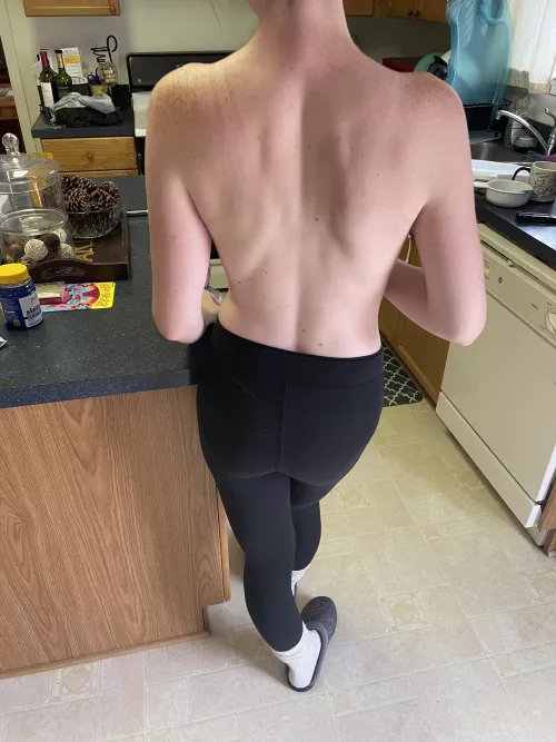 Do you like back freckles