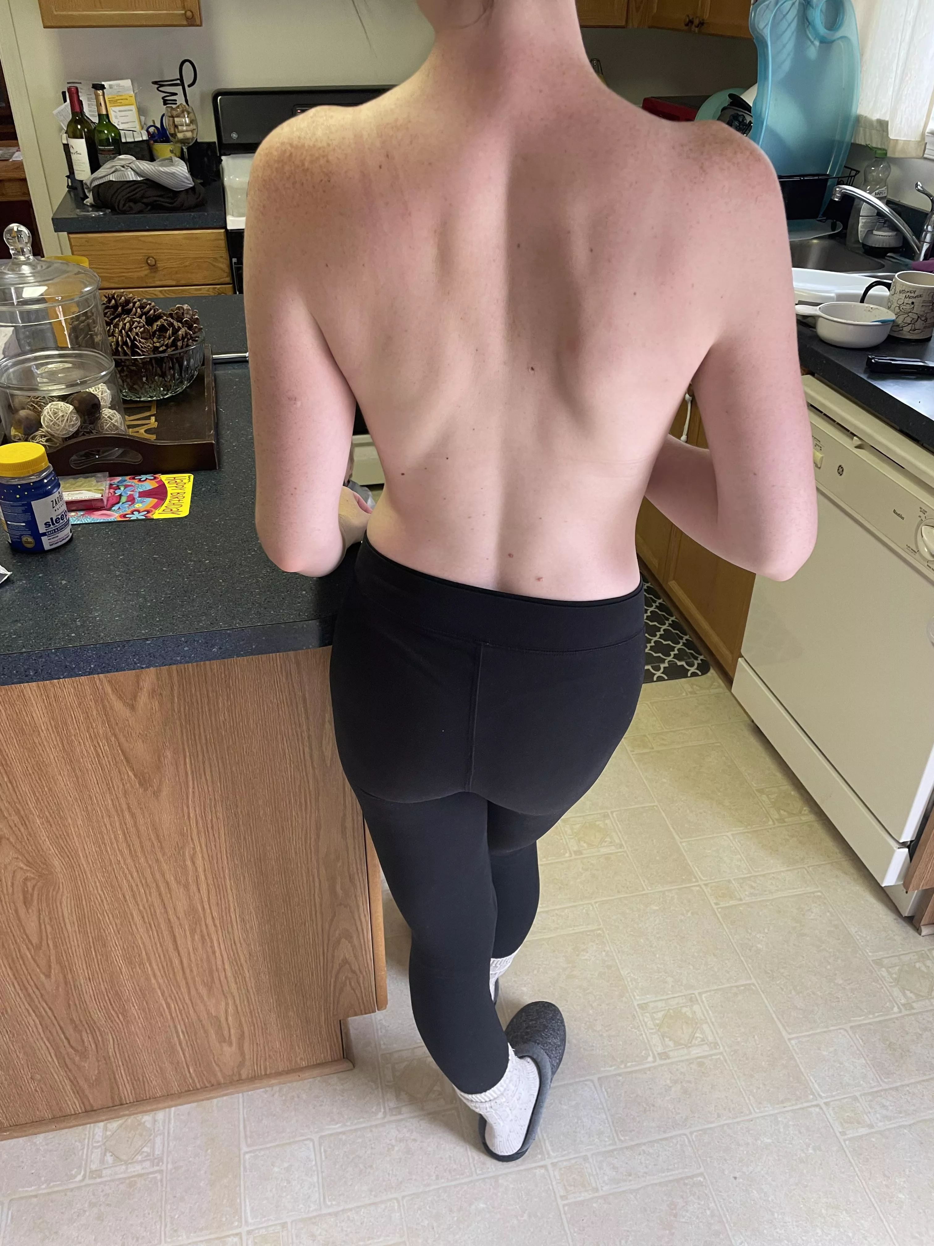 Do you like back freckles