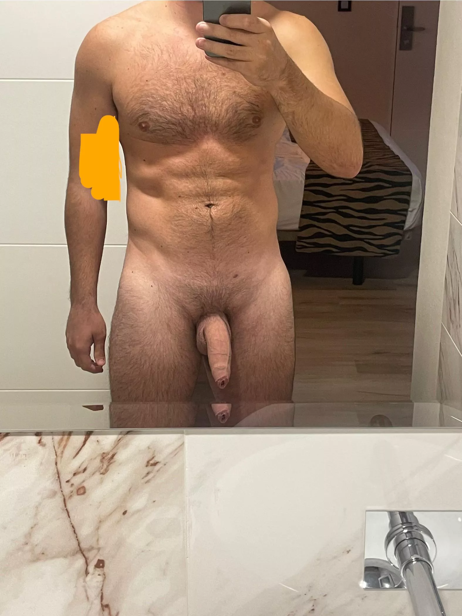 (m) 6 weeks post surgery, haven’t been able to do any exercise for 2+ months. Where do I stand?