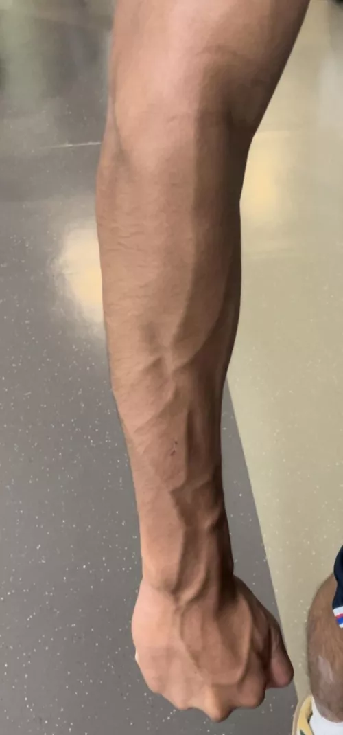 My vascular forearm can’t wait for a pump