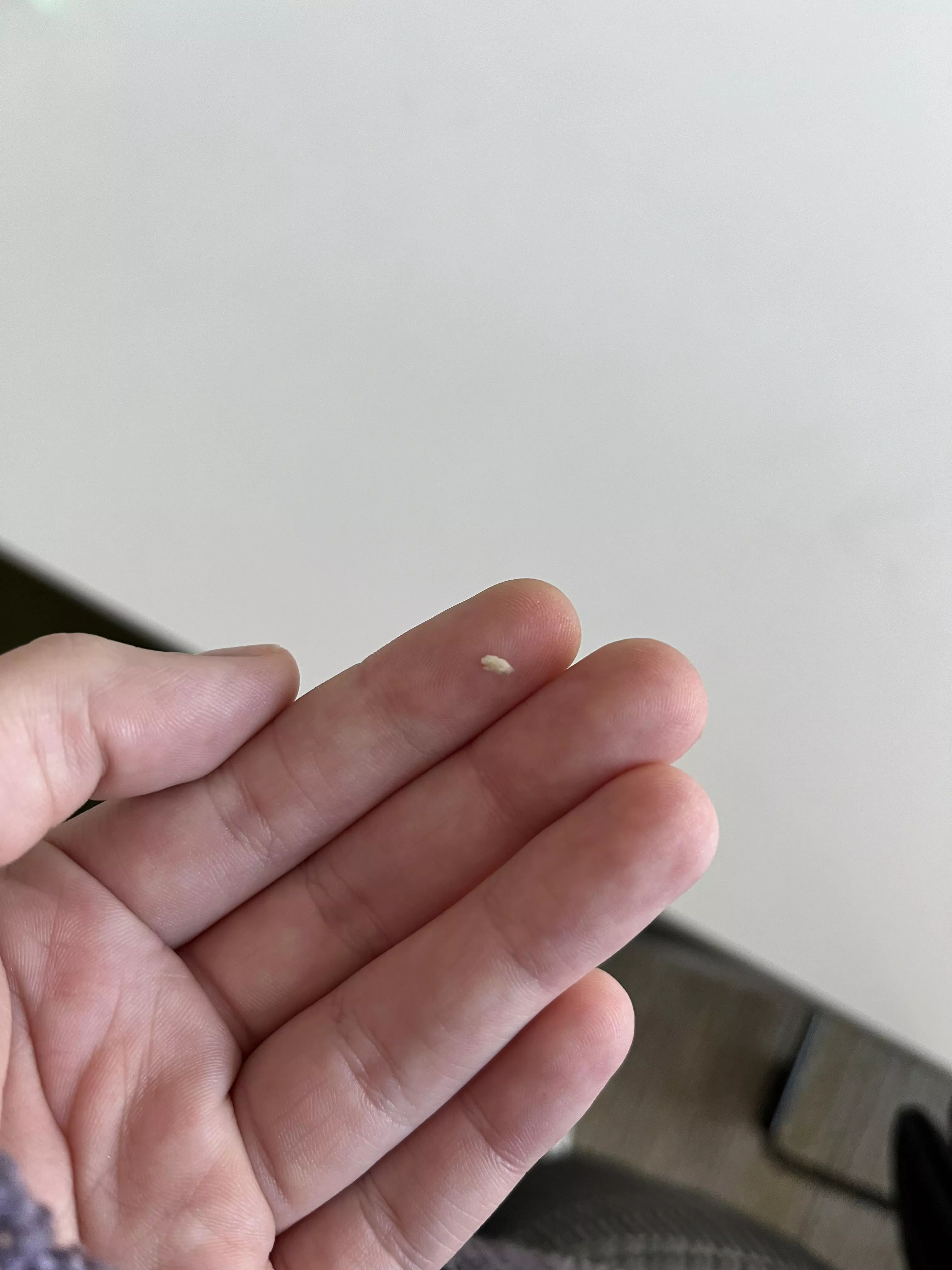 got wisdom teeth out a few months ago, and there’s been a shard of bone poking through my gum for AGES. it finally came out!!