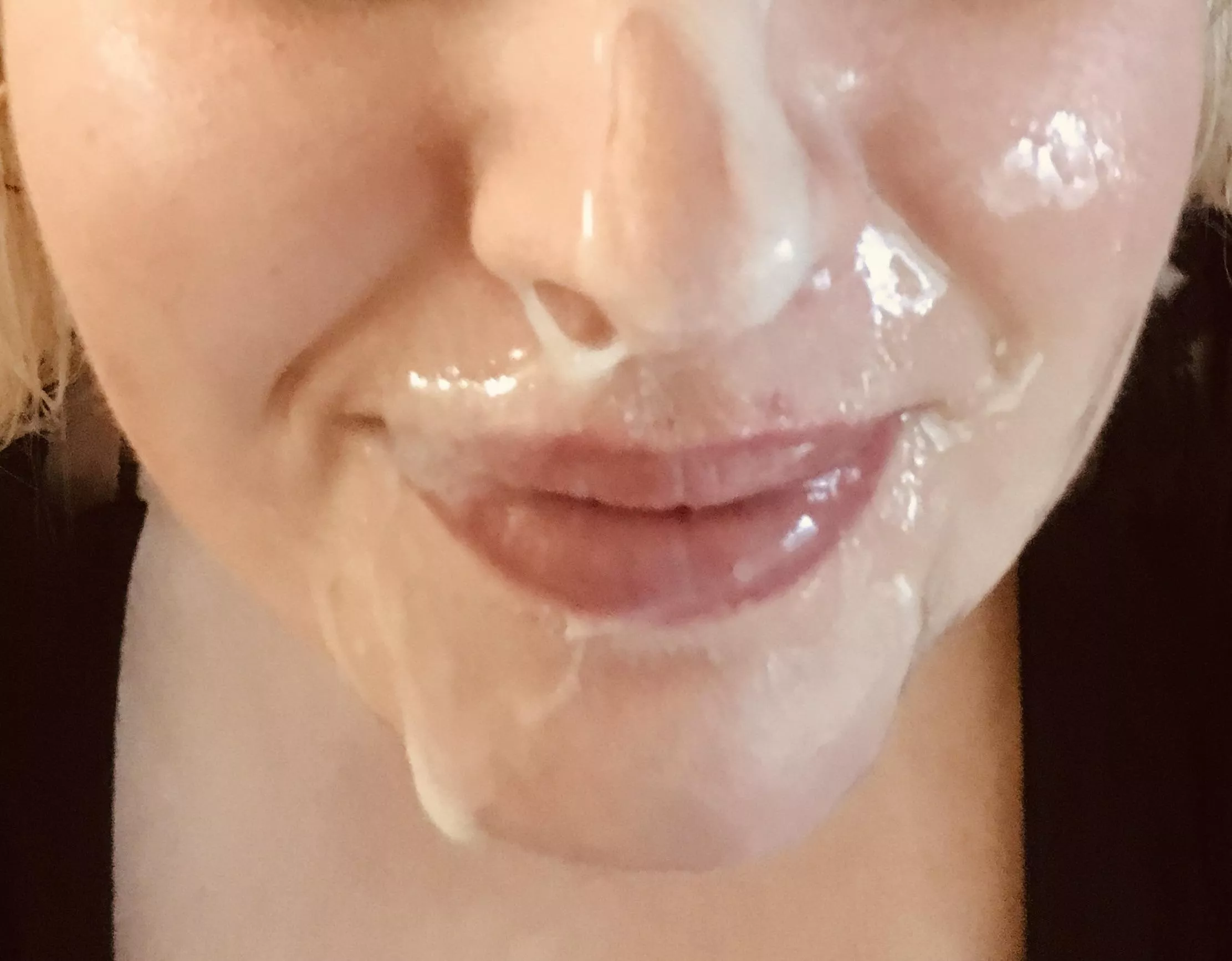 My face getting sown like a meadow 😂