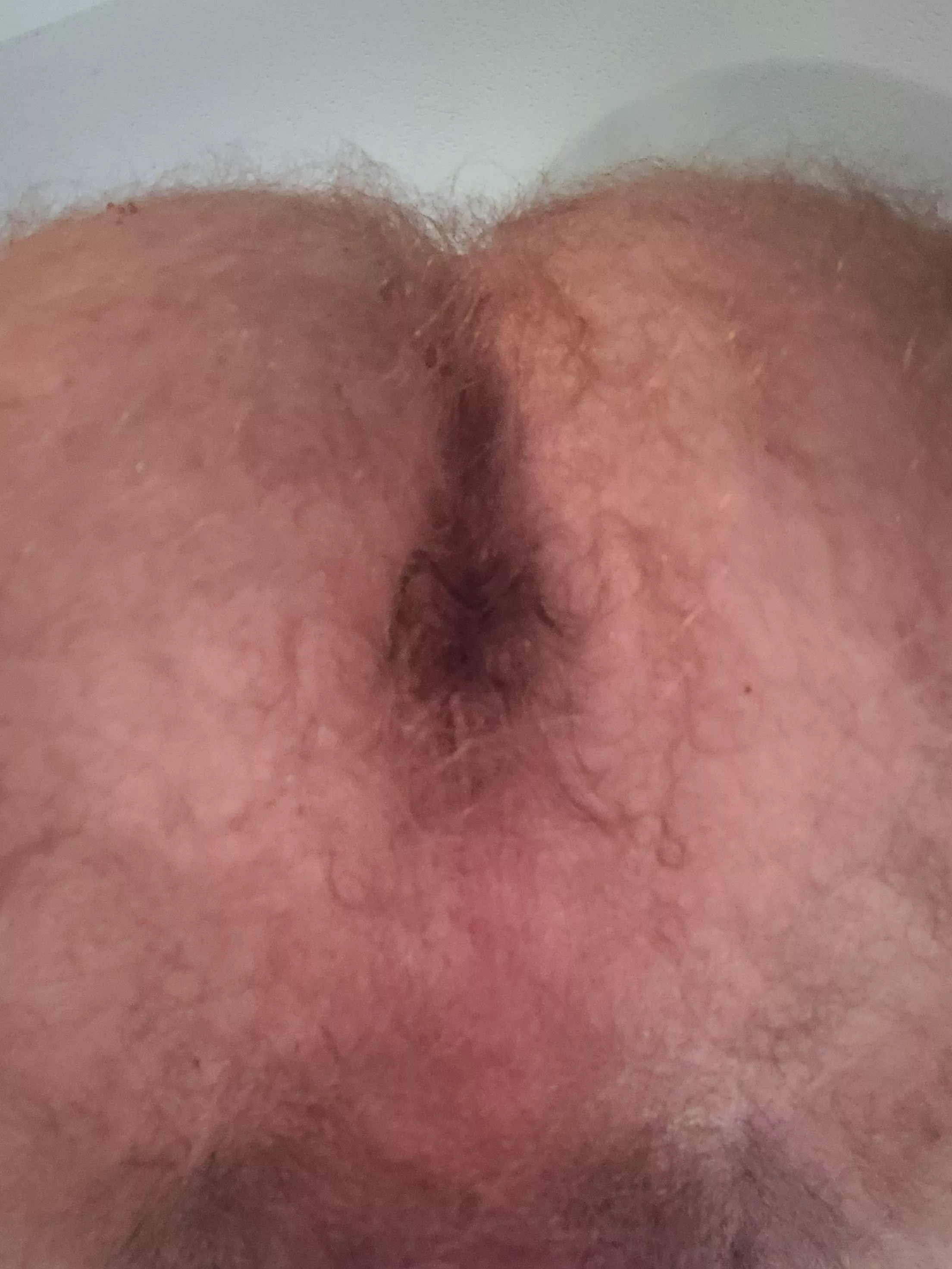 Hairy enough?