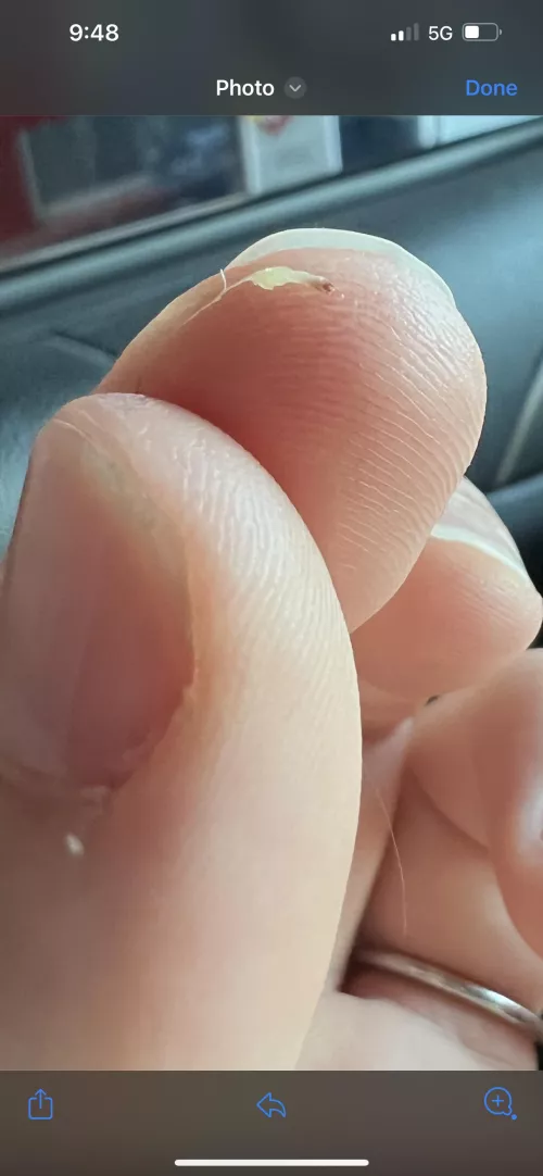 What the f just came out of my head?? Had a sore lump in my hair and pulled this out.. it was hard as a rock. What is it