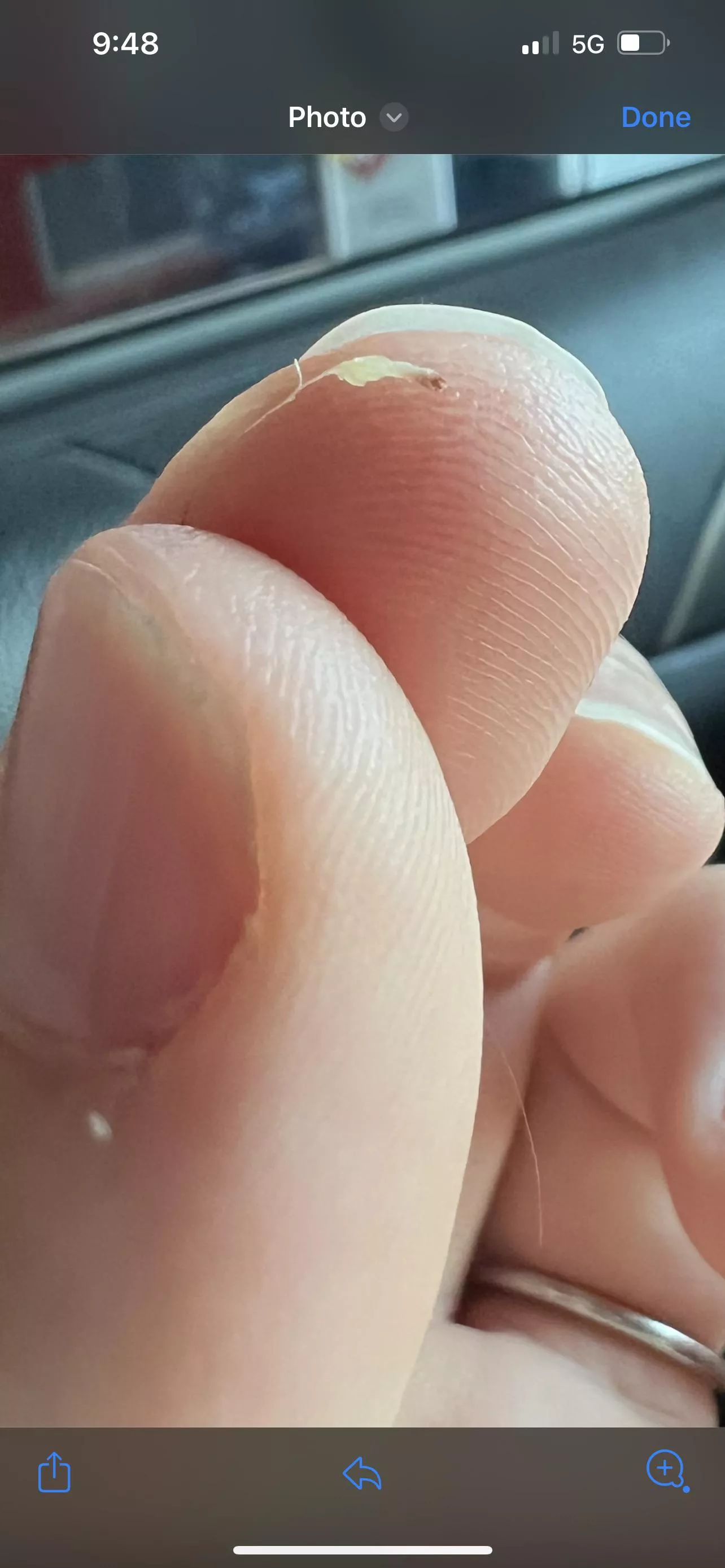 What the f just came out of my head?? Had a sore lump in my hair and pulled this out.. it was hard as a rock. What is it