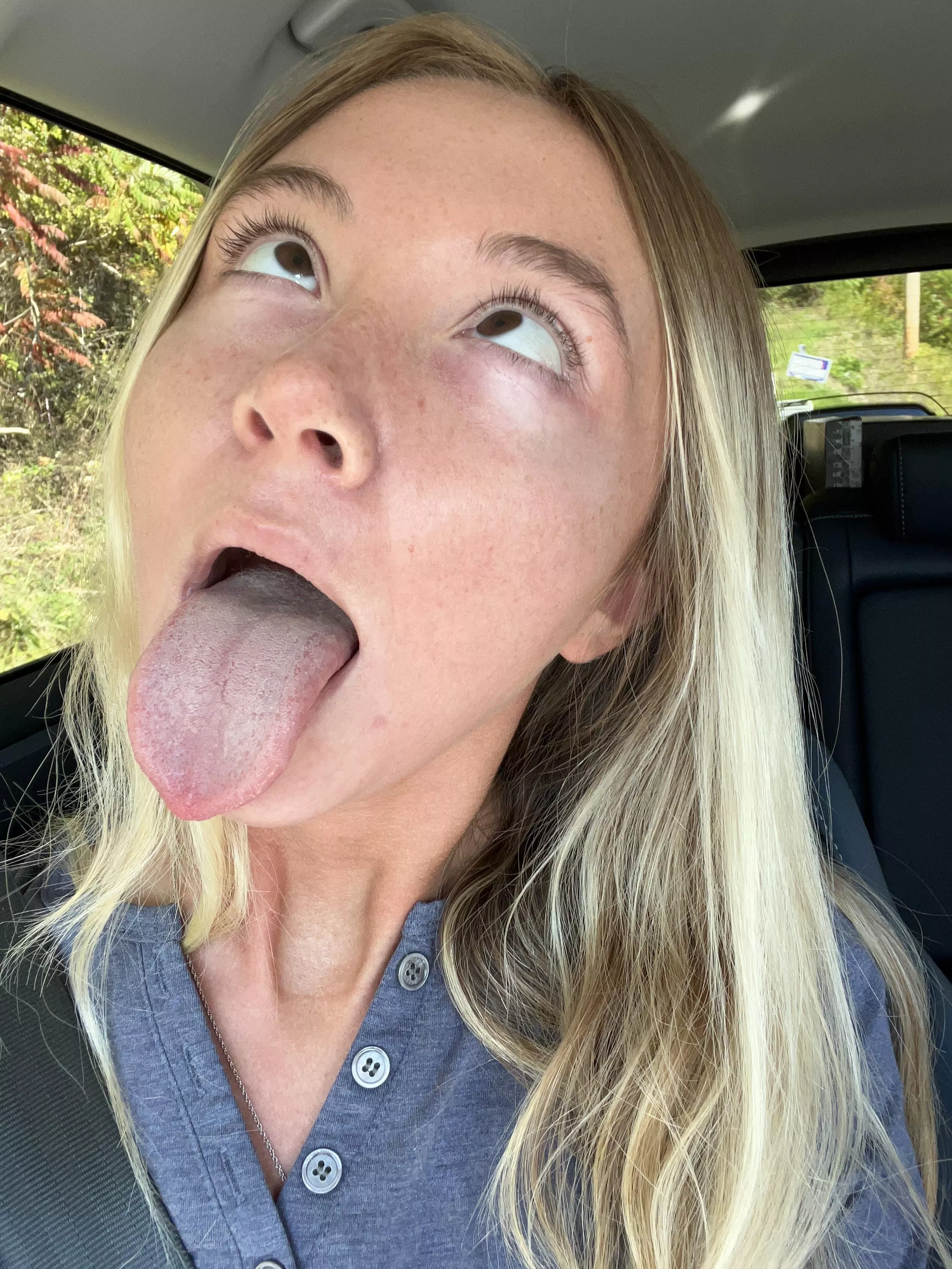 Guess who didn’t brush her tongue again. Filthy animal