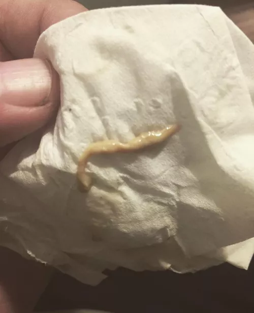 Pulled this fucker outta my junkial region