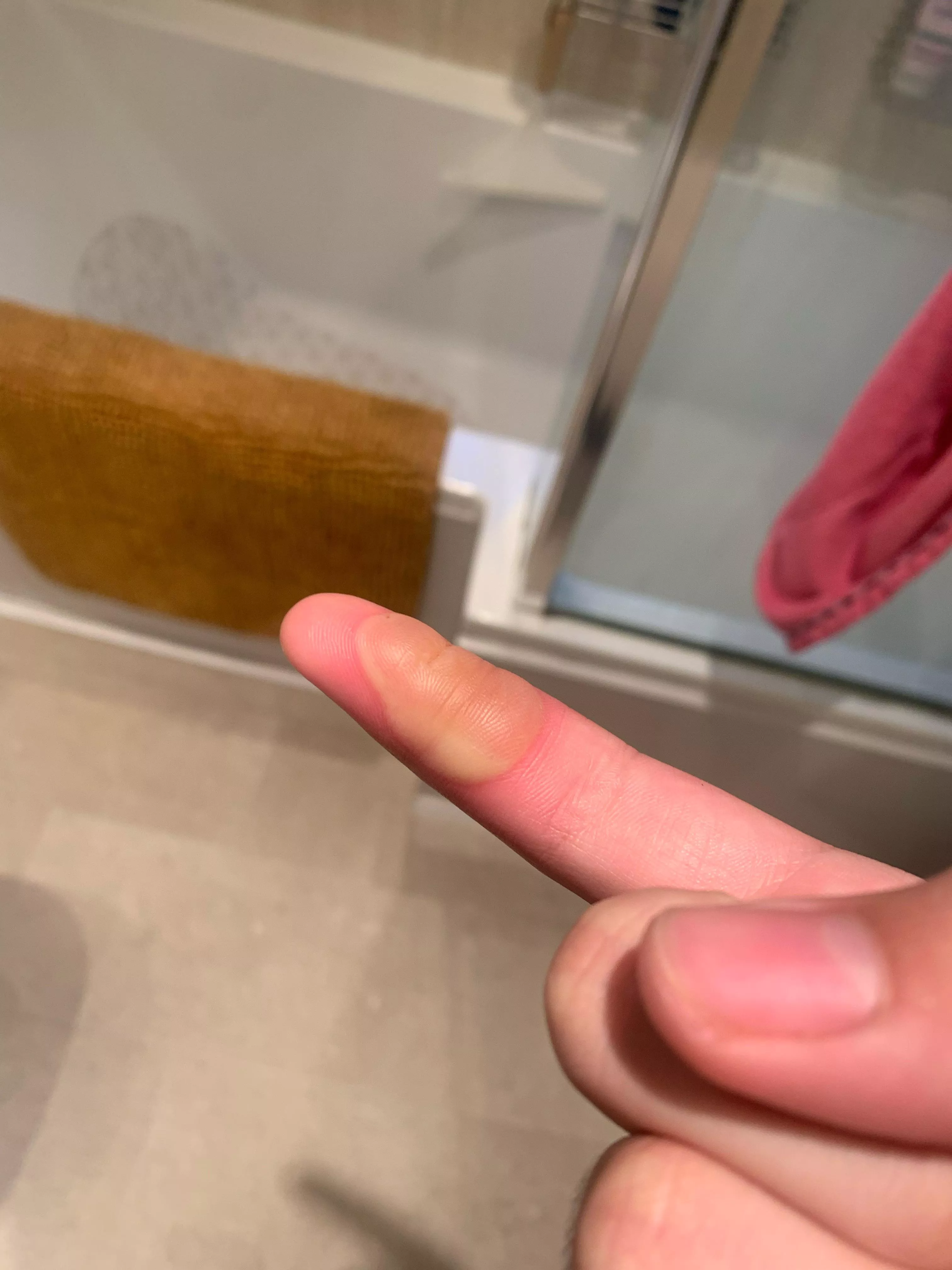 Should I pop this im scared it just formed on my cut