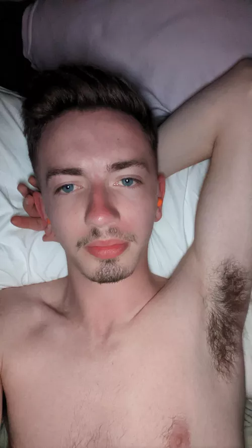 Excuse the sun burn from camping 😅