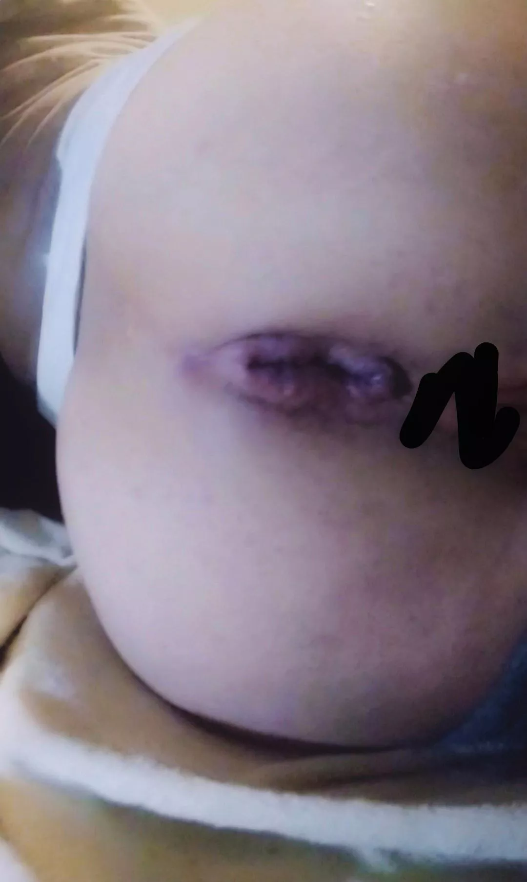 My poor butt after abusing it 😳 (oc) 27 f