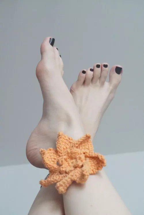 Tops or arches? 😁