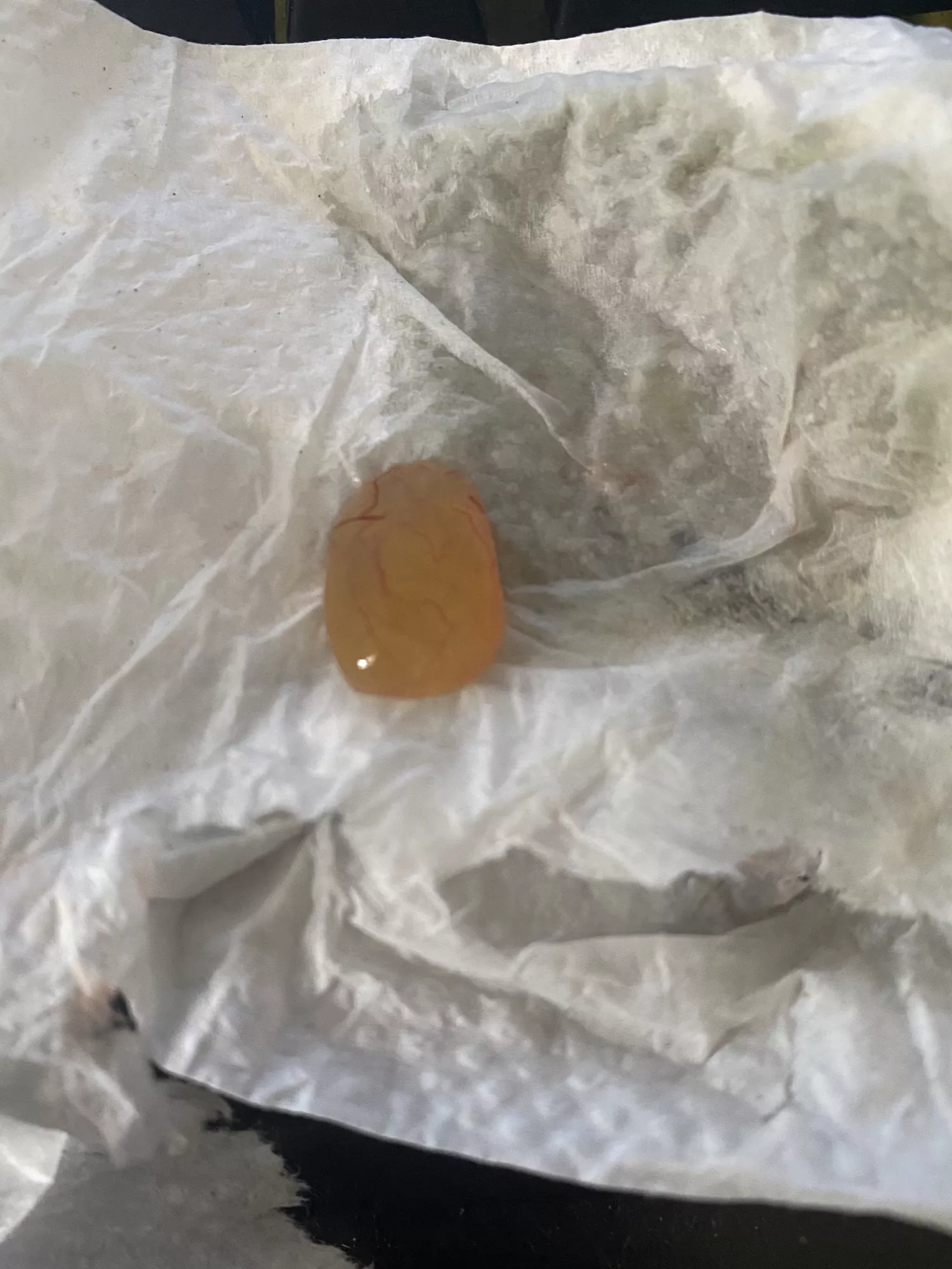 Had nasal polyp surgery for “the most extreme case I’ve ever seen (my surgeon). He put my on dupixent injection every two weeks. A couple weeks ago I felt something loose and blew my nose and this grape popped out