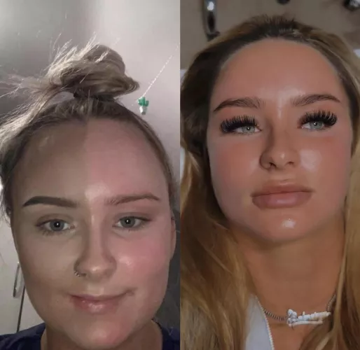 The difference three years (and various surgeries) can make! 😊